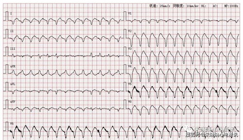 汽车9000转是多少迈(汽车转速与速度的深度解析,9000转对应多少迈? 汽车9000转是多少迈(汽车转速与速度的深度解析,9000转对应多少迈?