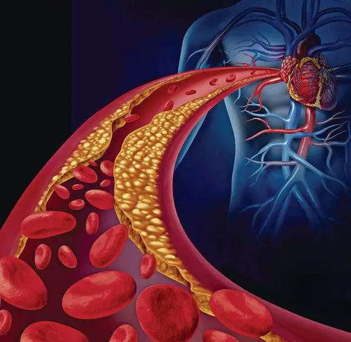 心脏房产怎么治疗最好