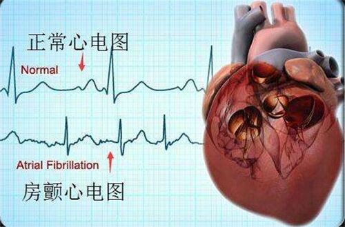 心脏房产怎么冶疗最好