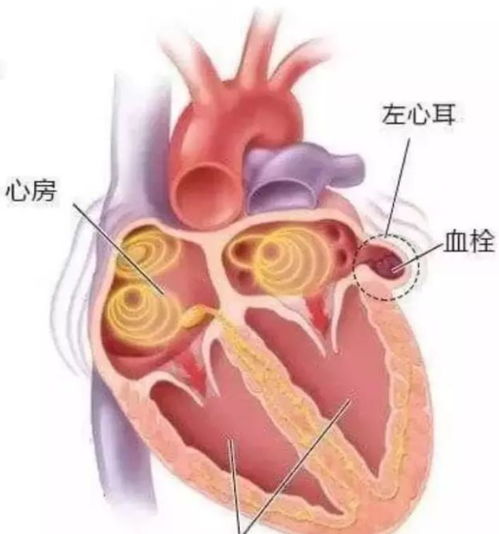 心脏房产怎么冶疗最好